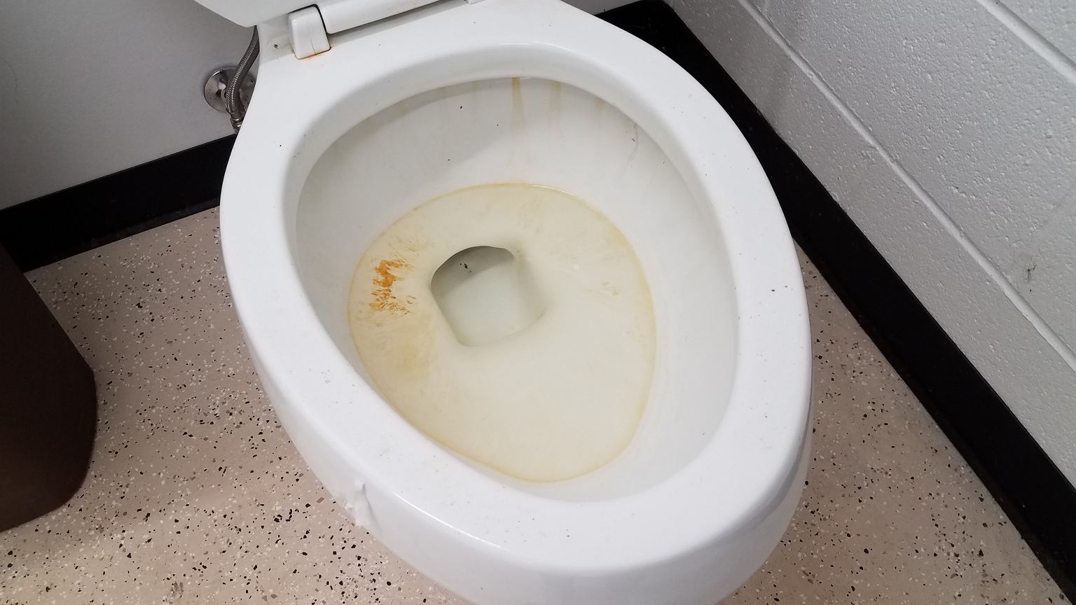 Żółty zaciek w muszli klozetowej spowodowany kamieniem moczowym